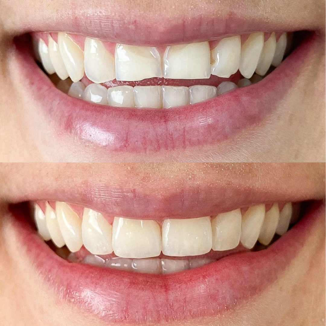Resultado de tratamento odontológico
