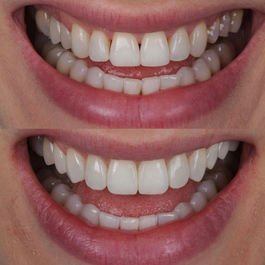 Resultado de tratamento odontológico