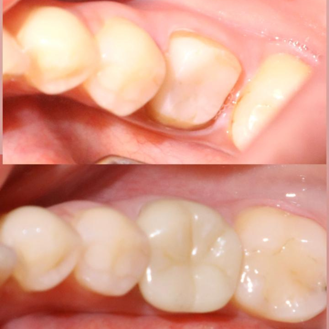 Resultado de tratamento odontológico