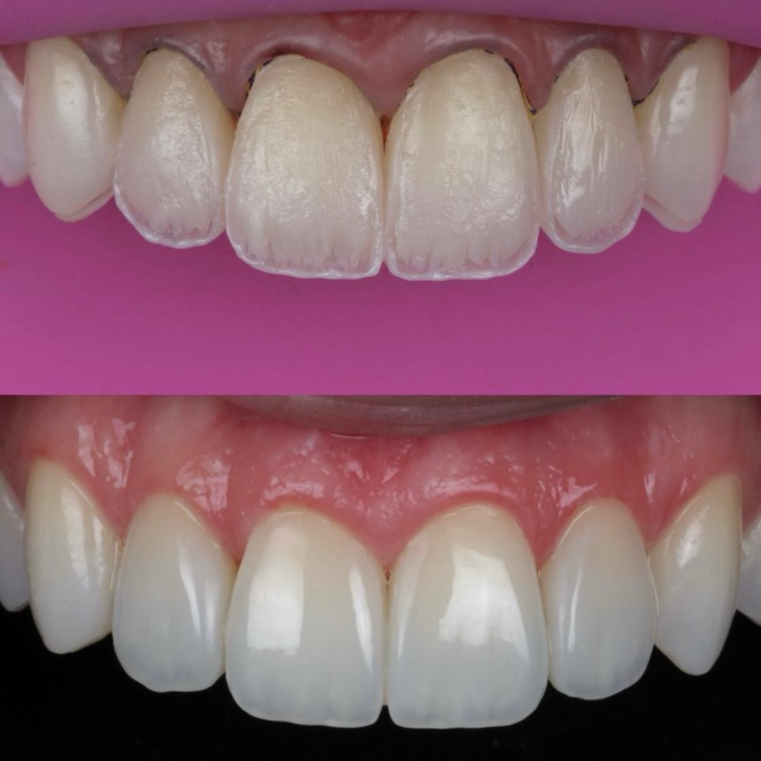 Resultado de tratamento odontológico